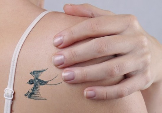 Laat uw tattoo weglaseren door de specialist van Nederland!